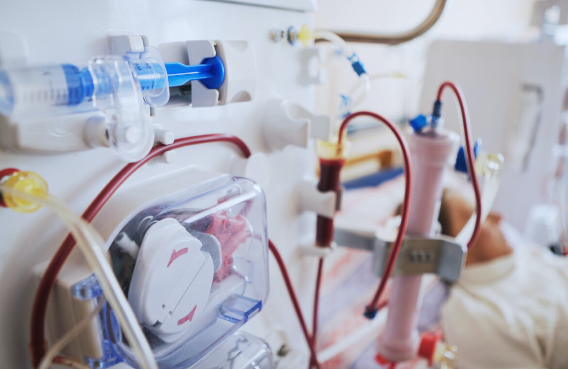 Chạy thận nhân tạo Hemodialysis