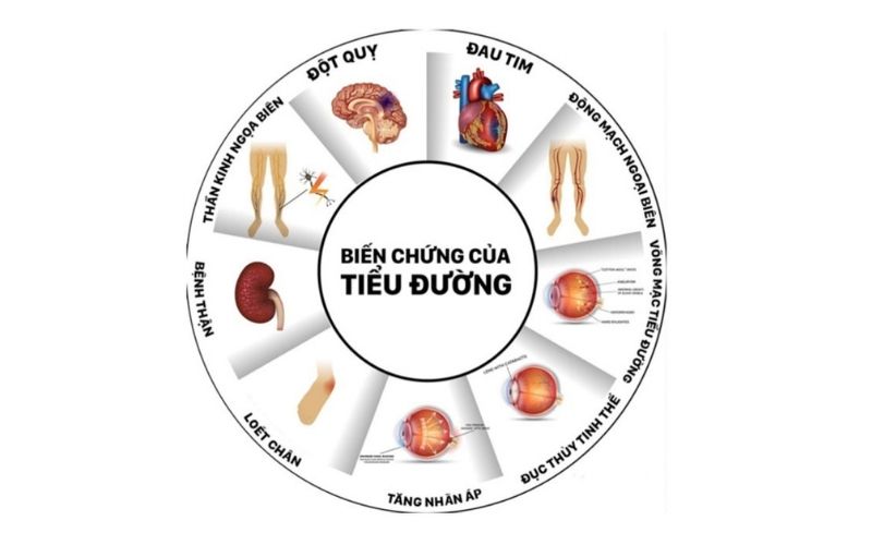 Biến chứng nguy hiểm dễ gặp của bệnh tiểu đường type 2