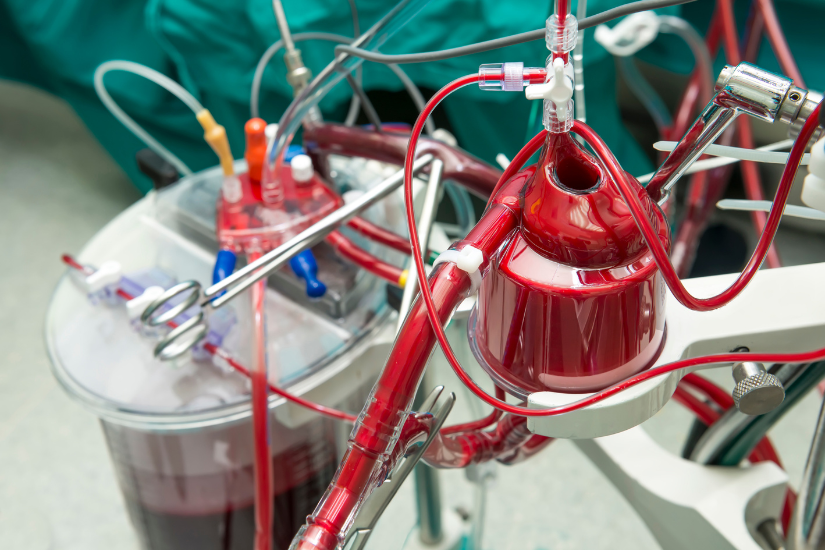 Phương pháp này không chỉ loại bỏ mỡ máu mà còn khắc phục các kháng thể gây hại, bảo vệ sức khỏe toàn diện.