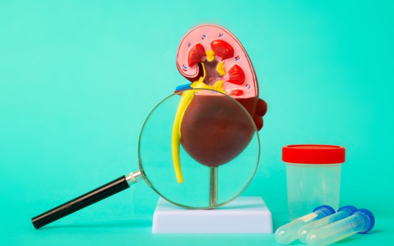 Chuẩn bị lọc máu thay thế thận