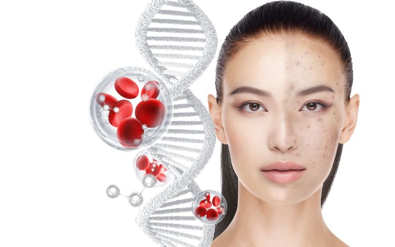 Sử dụng liệu pháp tái tạo da với công nghệ hiện đại bảo vệ làn da khỏi dấu hiệu lão hoá da