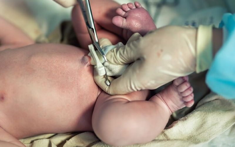 Tế bào gốc màng cuống rốn, lấy từ mô mềm của cuống rốn thai nhi