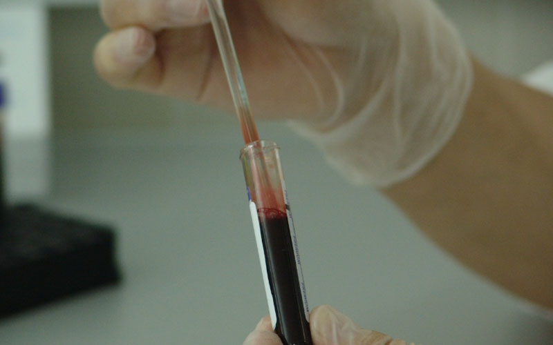 Dịch vụ tế bào máu là công nghệ tiên tiến trong điều trị và chăm sóc sức khỏe