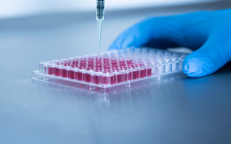 Xét nghiệm máu là một trong những dịch vụ tế bào máu