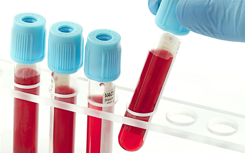 Dịch vụ xét nghiệm sức khỏe gồm những xét nghiệm nào?