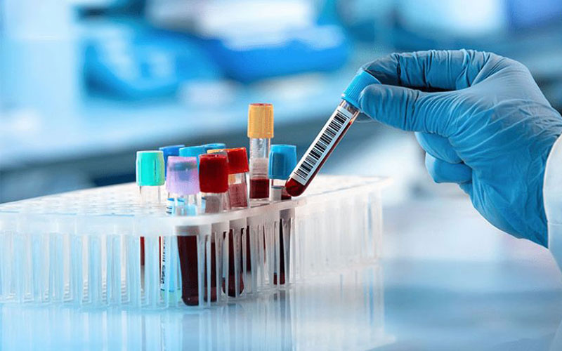 Tiêu chí lựa chọn địa chỉ cung cấp dịch vụ xét nghiệm sức khỏe