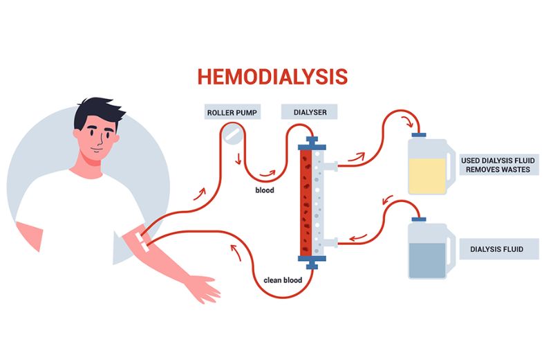 dieu-tri-loc-mau-suy-than-cap