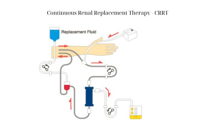 dieu-tri-loc-mau-suy-than-cap