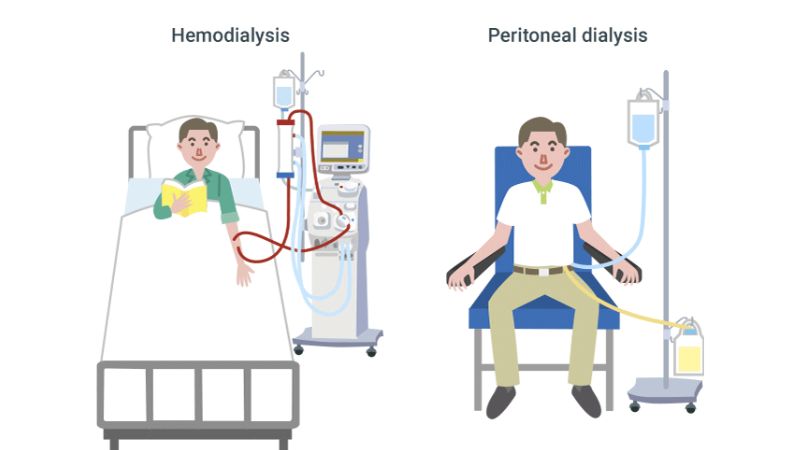 dieu-tri-loc-mau-tim-mach