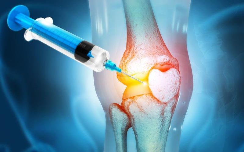 Ứng dụng hỗ trợ điều trị thoái hóa khớp bằng tế bào gốc