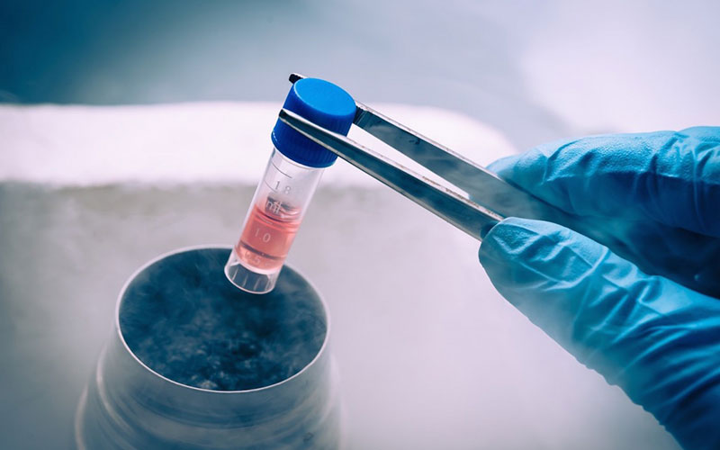 Cấy ghép tế bào gốc tự thân