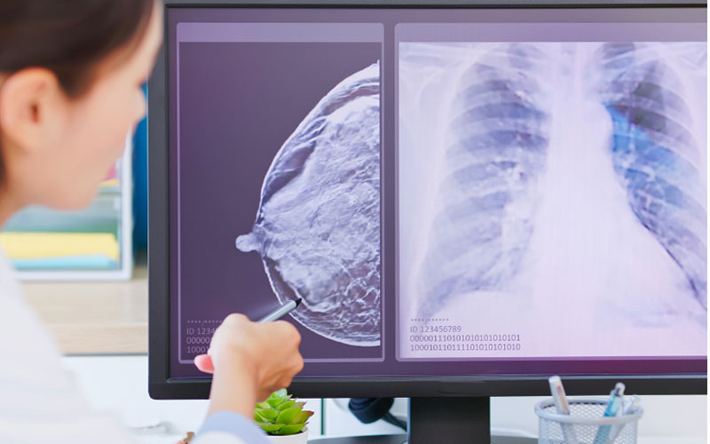 Điều trị ung thư vú bằng tế bào gốc phương pháp tiên tiến được nhiều bệnh nhân áp dụng