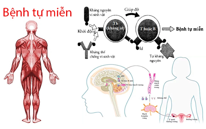 Đối tượng không nên đi xét nghiệm tế bào NK
