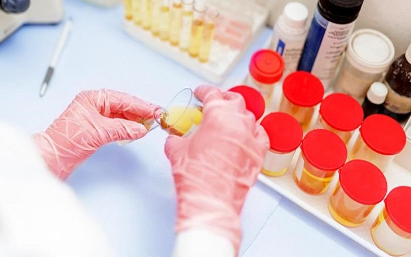 Xét nghiệm máu và nước tiểu