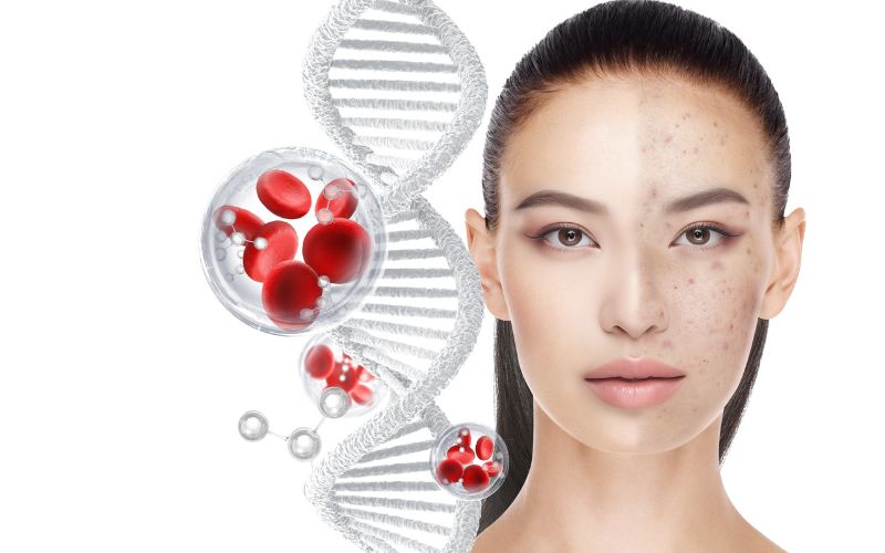 Công nghệ y học tái tạo chống lão hoá da không xâm lấn, phẫu thuật