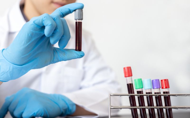 loc-mau-benh-nhan-tim-mach