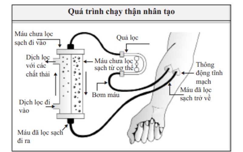 loc-mau-benh-nhan-tim-mach
