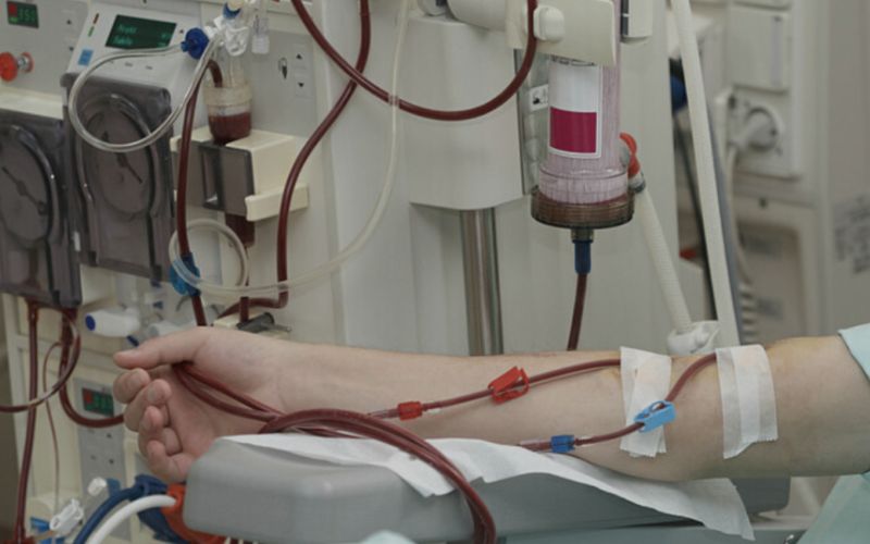 loc-mau-duong-tieu-hoa-cho-benh-nhan-suy-gan-do-ung-thu-gan