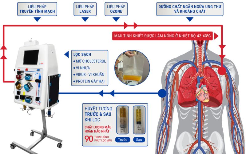 loc-mau-duong-tieu-hoa-cho-benh-nhan-suy-gan-do-ung-thu-gan