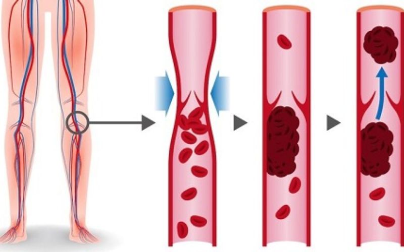 loc-mau-trong-dieu-tri-suy-than