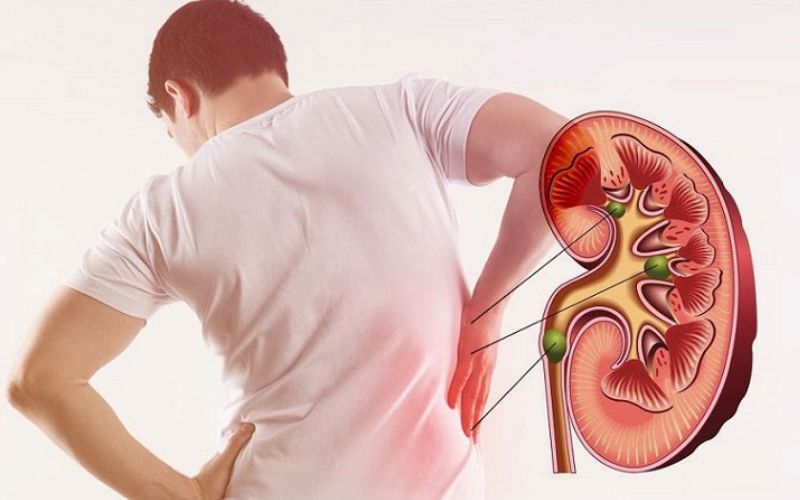 loc-mau-trong-dieu-tri-suy-than