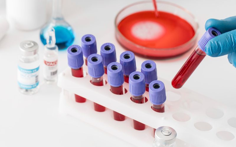 Phương pháp lọc máu xấu cho người tiểu đường hỗ trợ tăng cường chất lượng sống