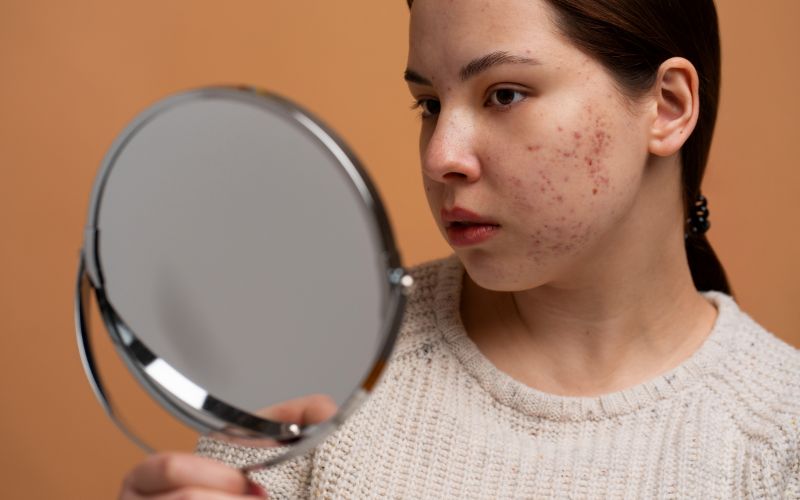 Gặp các vấn đề về da đang gặp khó khăn cần sự hỗ trợ lọc máu xấu thải độc cơ thể hiệu quả.