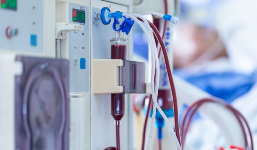 Nguyên lý hoạt động của máy lọc máu