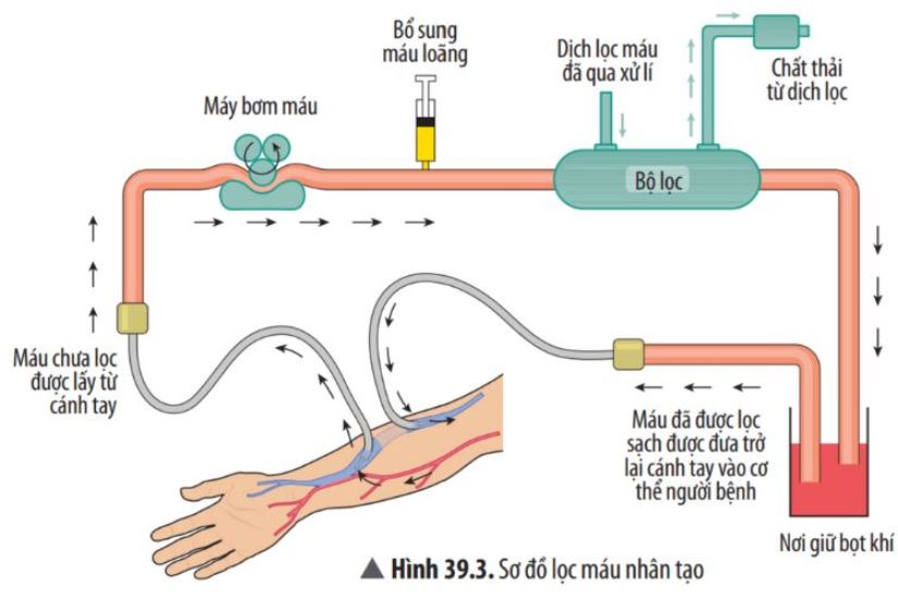 Phương pháp lọc máu tuần hoàn Nhật Bản là gì?