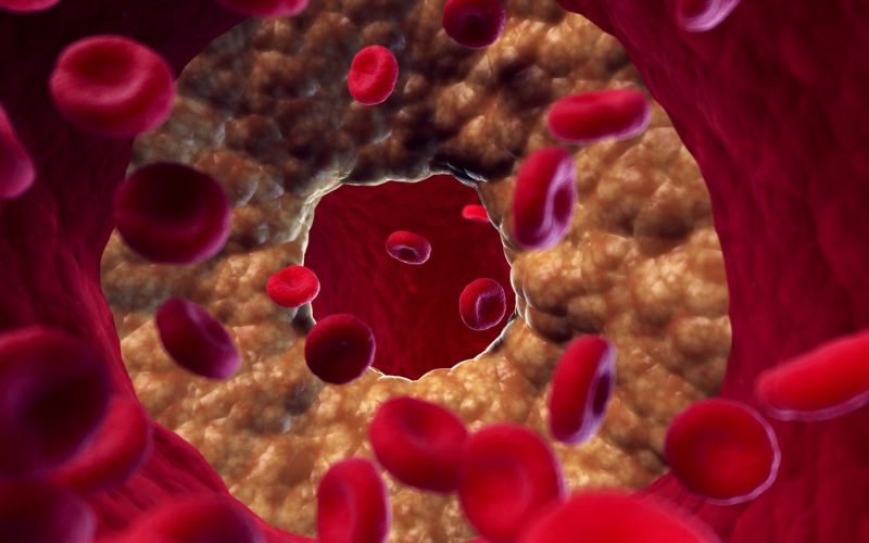 Ngăn ngừa hình thành máu đông và mảng bám