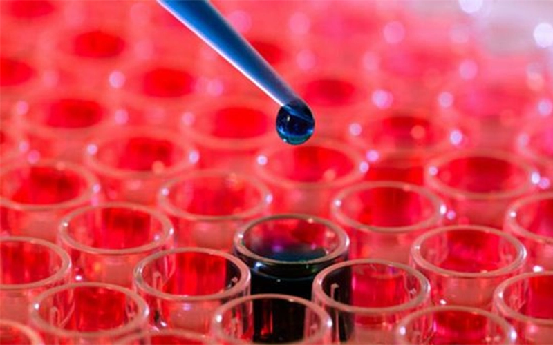 Tại sao cần xét nghiệm NK