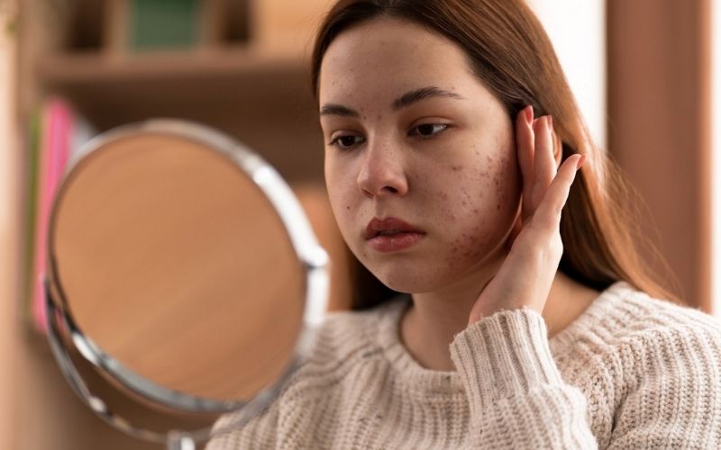 Tái tạo da bằng tế bào gốc giảm viêm, kích thích quá trình làm lành da