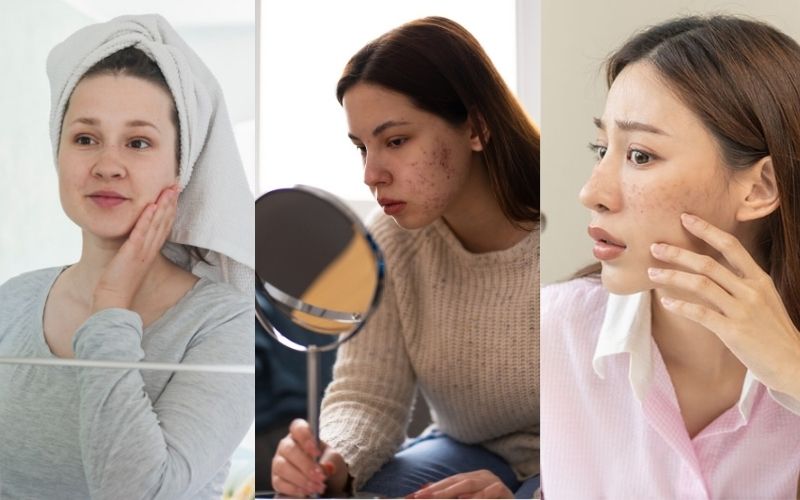 Xu hướng ứng dụng làm đẹp từ tái tạo da bằng tế bào gốc