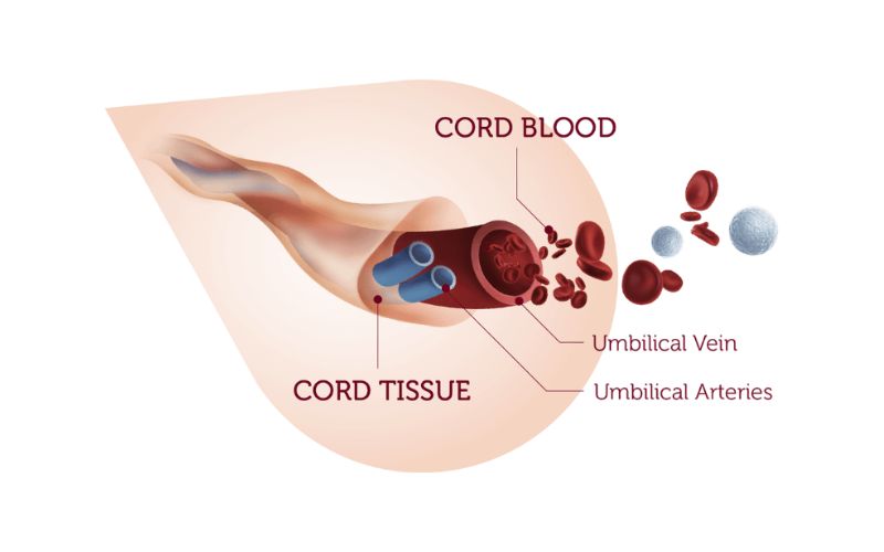 Tế bào gốc trung mô dây rốn hay còn gọi là tế bào gốc “0 tuổi”.