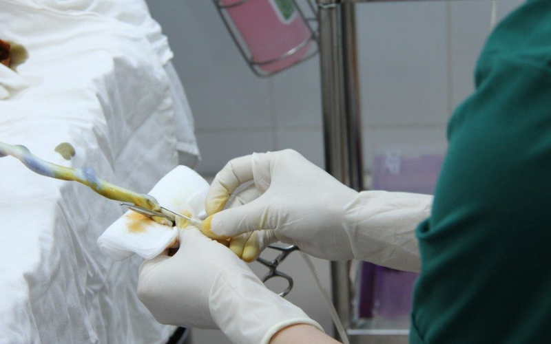 thu thập tế bào gốc trung mô quấn rốn