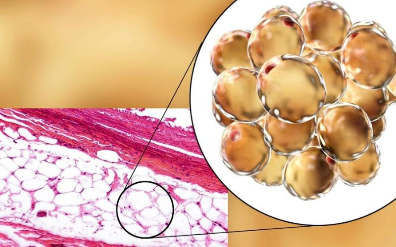 Tế bào gốc tự thân từ mô mỡ (hay còn gọi là tế bào gốc mô mỡ) được lấy từ các khu vực có mỡ thừa trên cơ thể