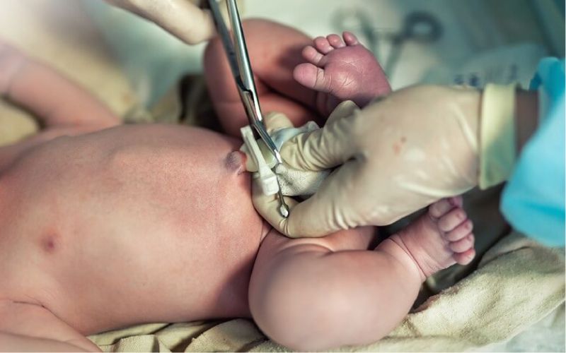 Tế bào gốc màng cuống rốn hay còn được gọi là tế bào gốc “0 tuổi” được thu thập từ cuống rốn của trẻ sơ sinh