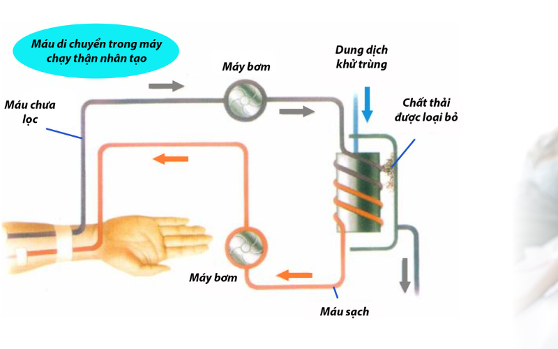 quy trình lọc máu trong thiết bị lọc máu cho bệnh nhân suy thận