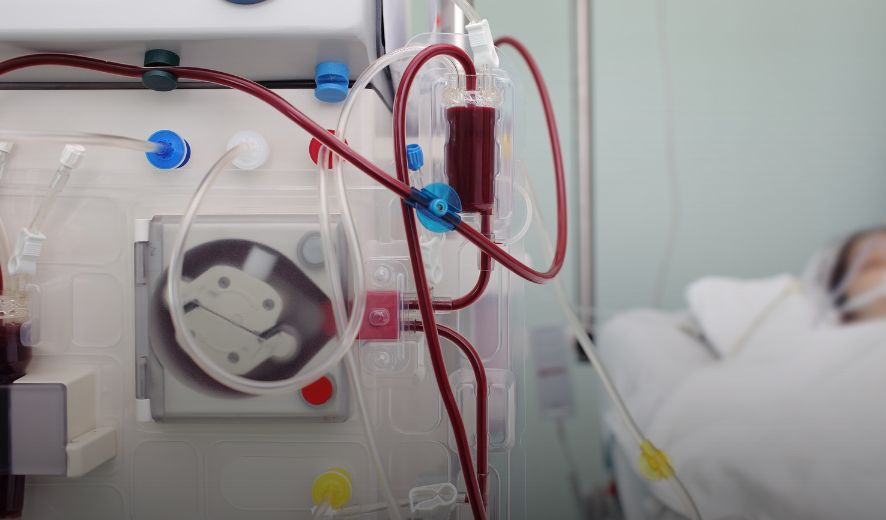 Thiết bị lọc máu cho bệnh nhân suy thận