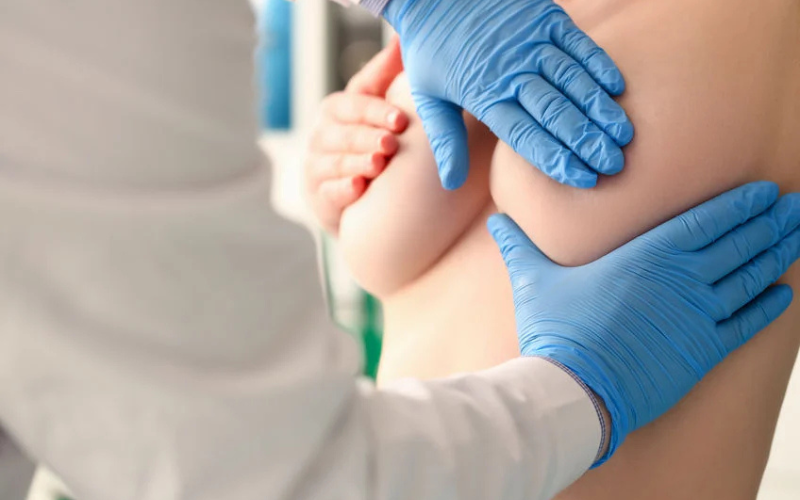 trẻ hoá da ngực bằng tế bào gốc