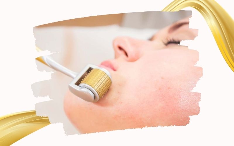 Trẻ hóa da mặt bằng tế bào gốc cho da mụn