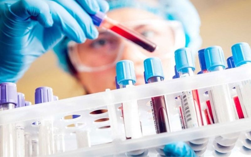 Xét nghiệm tế bào NK có ý nghĩa gì?