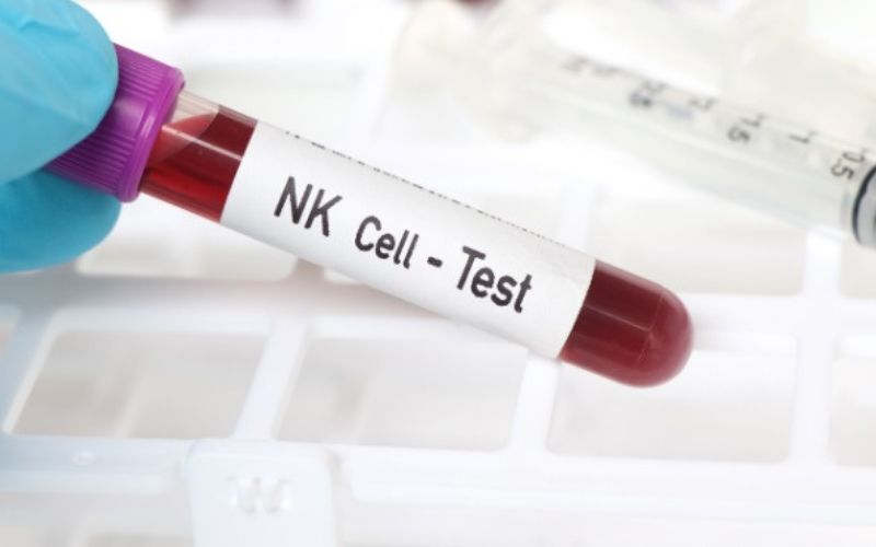 Kết quả xét nghiệm NK