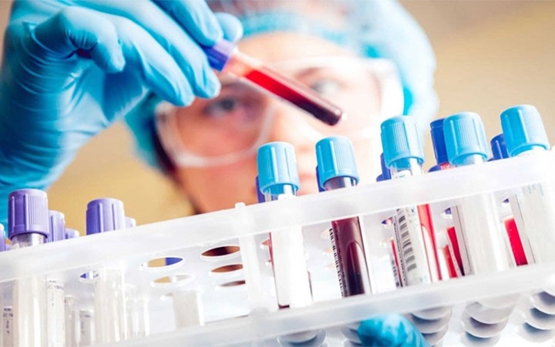 Xét nghiệm tế bào NK bao nhiêu tiền